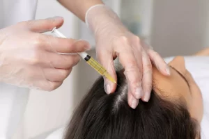 Steps to Integrate Dr. CYJ Hair Filler into Your Practice