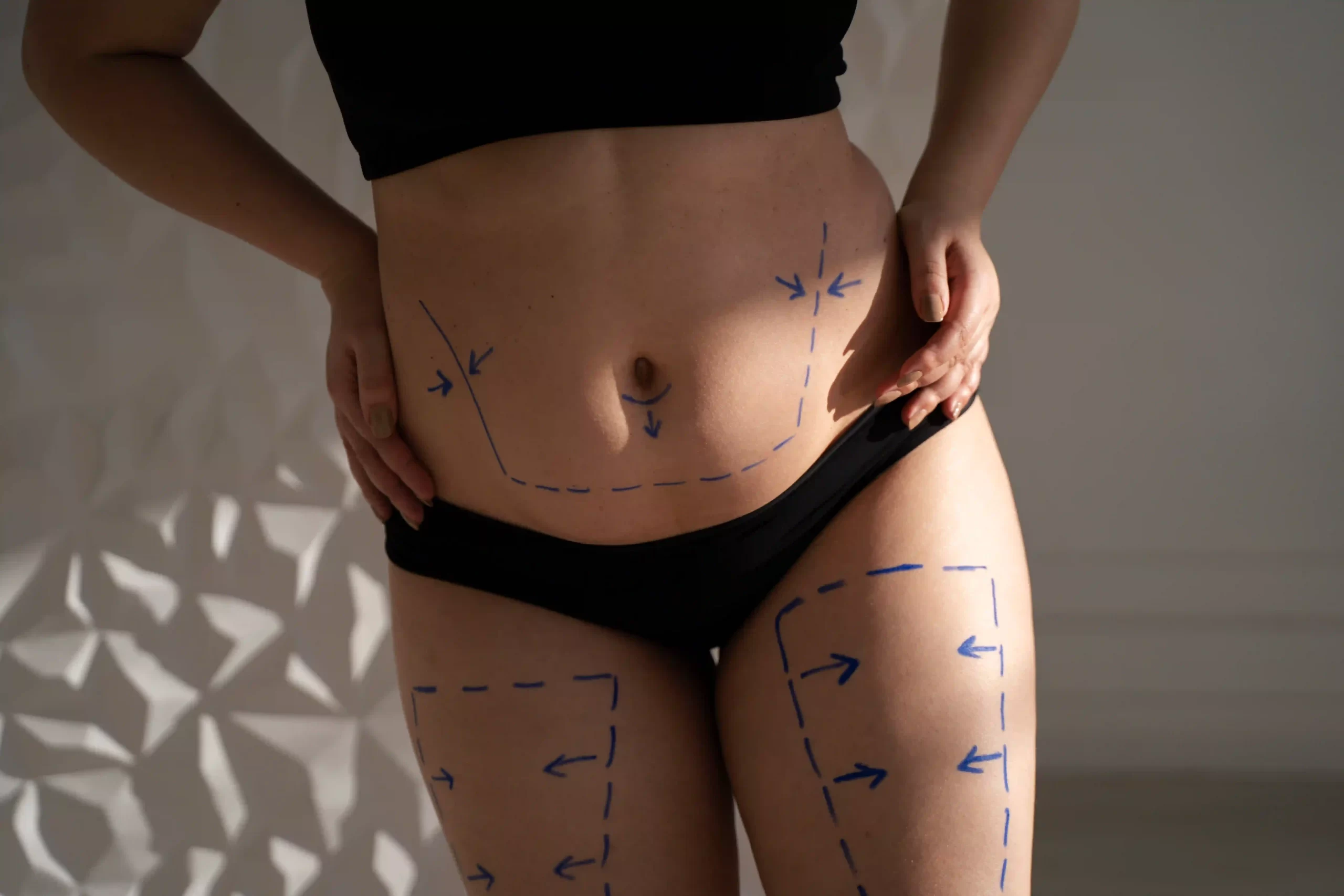 front view woman s body with marker traces ()