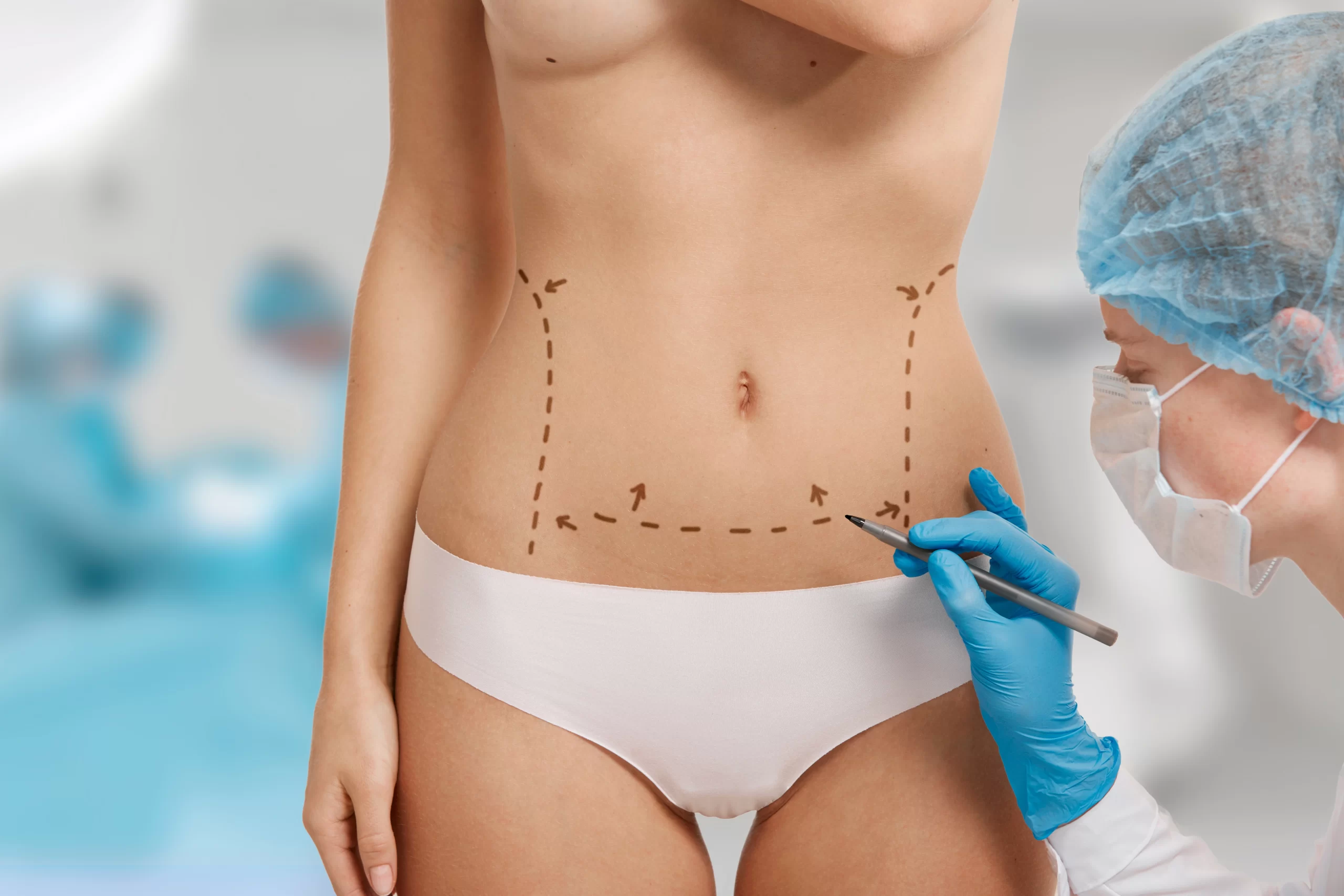 Benefits of Buying Lipo Lab PPC in Bulk for Your Clinic