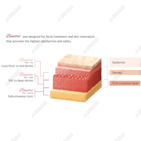 bonetta filler areas