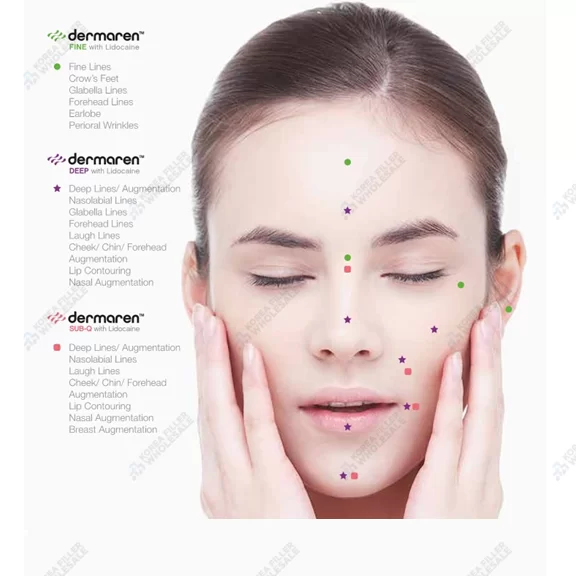 dermaren filler application areas