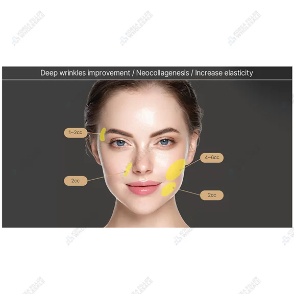 etrebelle 200mg plla filler application areas