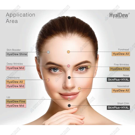 hyaldew ce filler application areas