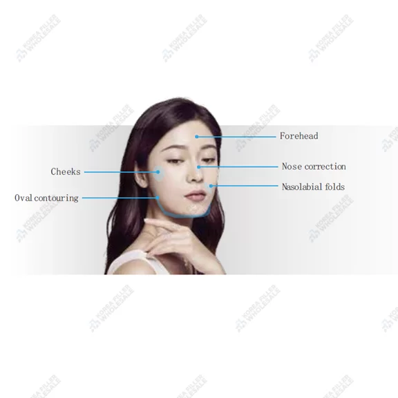 replengen ideology 200mg plla filler application areas